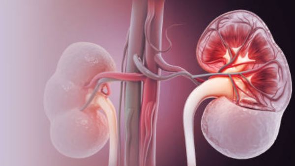 how to know if kidney is damage