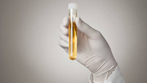 self urine test