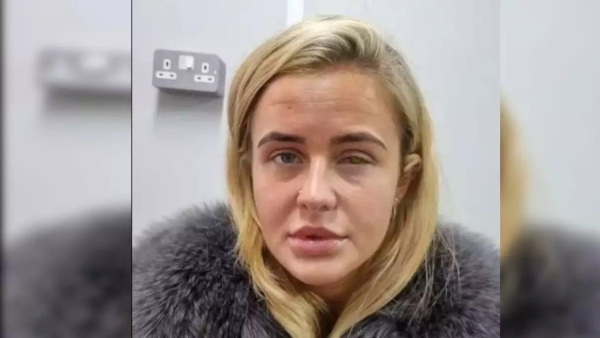 Corneal ulcer kya hai