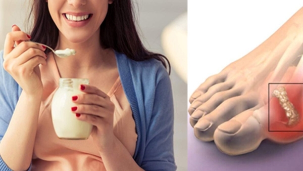 Can We Drink Lassi or buttermilk in Uric Acid