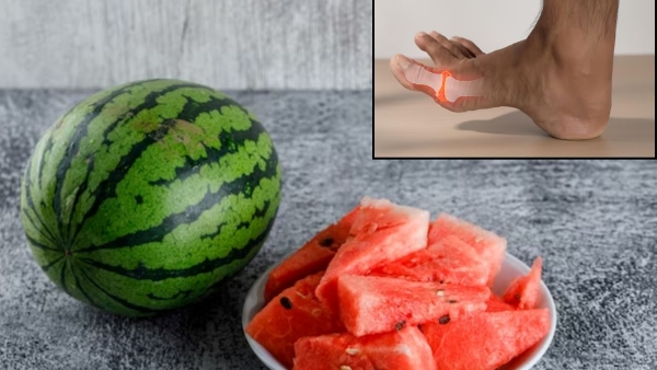 Is Watermelon good for Uric Acid Me Tarbuj Khana Cahiye Ya Nhi