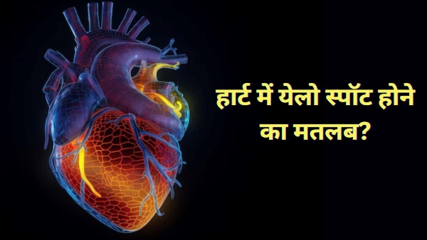 yellow area in heart Know what does Mean