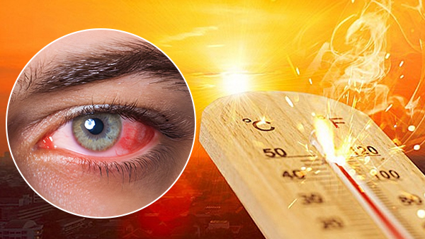 how to protect your eye in heatwave