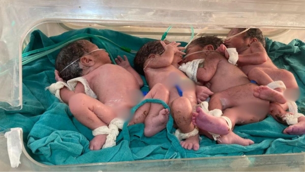 What is Quadruplets Pregnancy