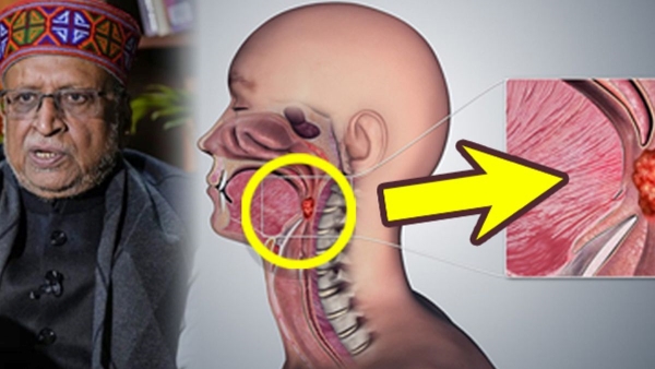 Sushil Kumar Modi was Suffering from throat Cancer