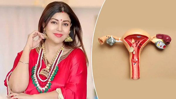Debina Bonnerjee is suffering from endometriosis