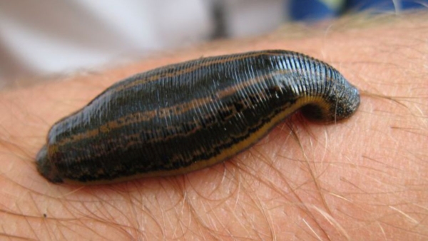 How to safely remove a leech at home