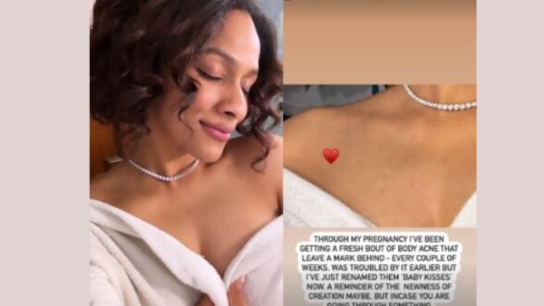 Masaba Gupta Reveal about body acne during pregnancy