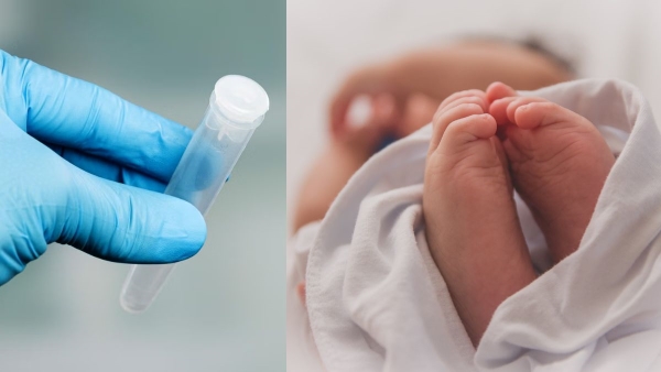 What is Posthumous Sperm Retrieval