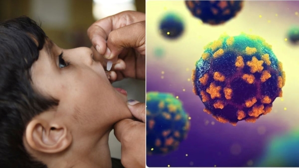 Wild Poliovirus cause