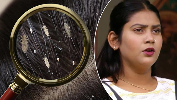 Home Remedies Of Lice Ju Hatane Ka Gharelu Upay