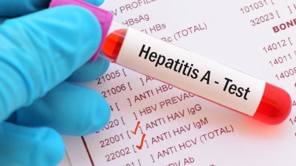 food and water risks amid rise in Hepatitis A cases In Delhi food and water risks amid rise in Hepatitis A cases In Delhi