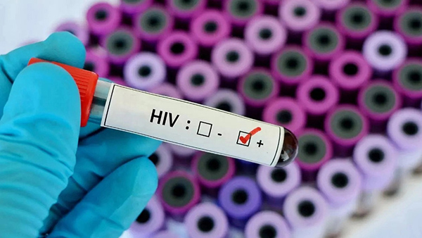 Tripura Hiv Cases How Does Human Immunodeficiency Virus