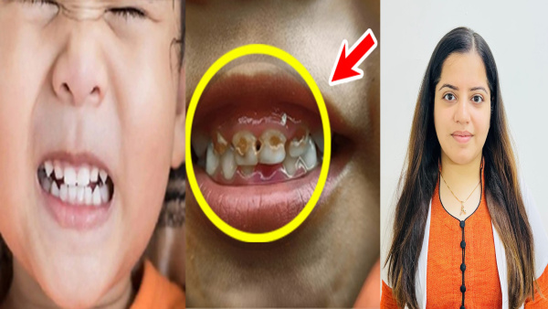 Exclusive How to Take Care of Oral Hygiene in babies Expert tips on dental care in toddlers