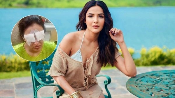 Jasmin Bhasin Suffers Corneal Damage Jasmin Bhasin Suffers Corneal Damage