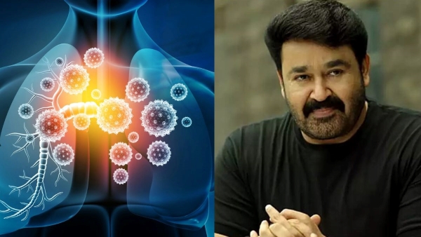 Actor Mohanlal suffering from viral respiratory infection