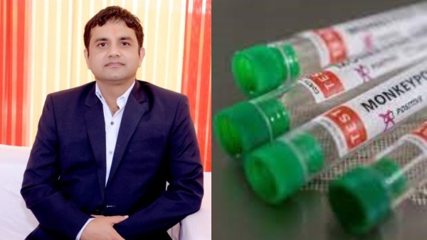 How fast does monkeypox spread and should India worry