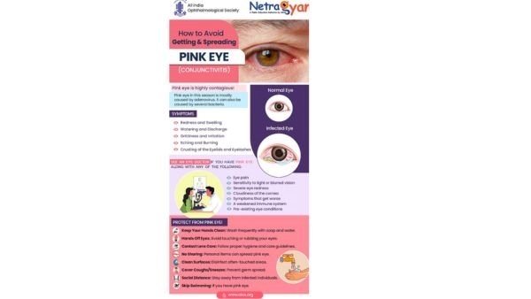 How To Protect Yourself From Pink Eye In Rainy Season As Per Experts in Hindi