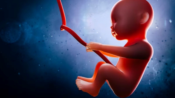 What is Fetus in Fetu Rare Case Found in sagar