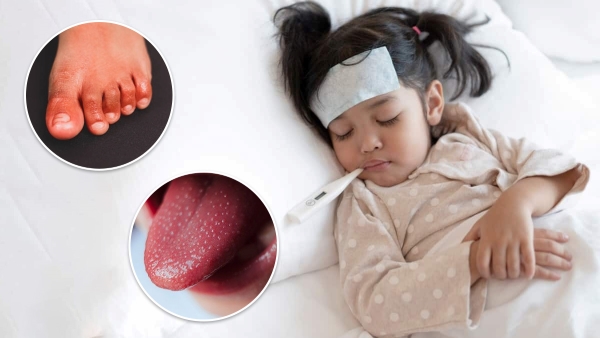 What is Kawasaki disease