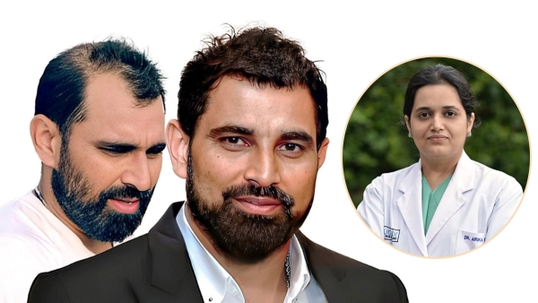 Male Pattern Baldness Causes and Symptoms