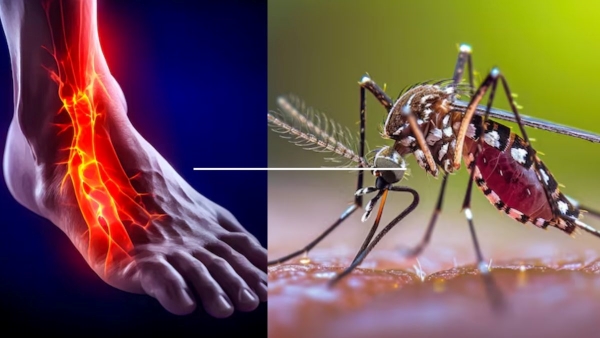 Langra Bukhar in Patna