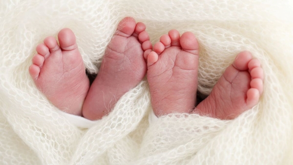 Bikaner Harlequin-type ichthyosis Twins Birth Case