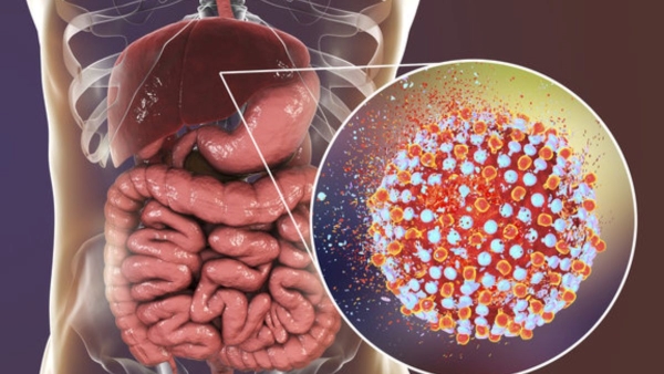 Hepatitis A outbreak in Kerala