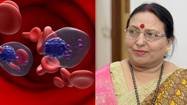 Sharda Sinha Health News