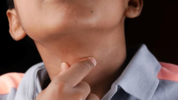 Hyderabad Boy Dies After Stuffing Mouth With Three Pooris Together