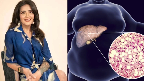 grade 3 fatty liver symptoms and cause