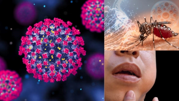 5 Most Dangerous Diseases Spreads This Year 5 Most Dangerous Diseases Spreads This Year