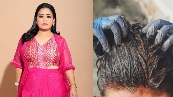 Stand-Up Comedian Bharti Singh s DIY White Hair Solution