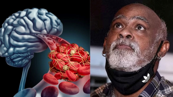 Vinod Kambli Brain Clots