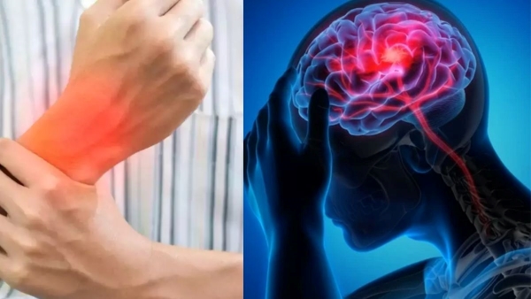 Guillain Barre Syndrome In Rajasthan