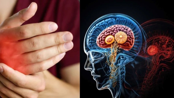 Guillain-Barre Syndrome