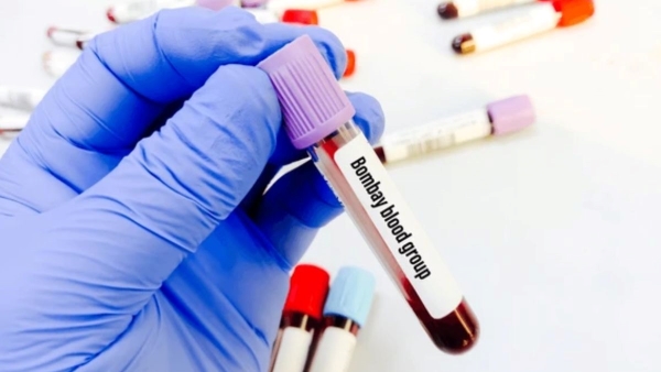 What is Bombay Blood Group