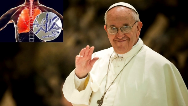 Pope Francis Suffering From Double Pneumonia