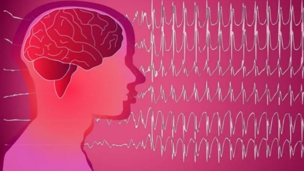 International Epilepsy Day