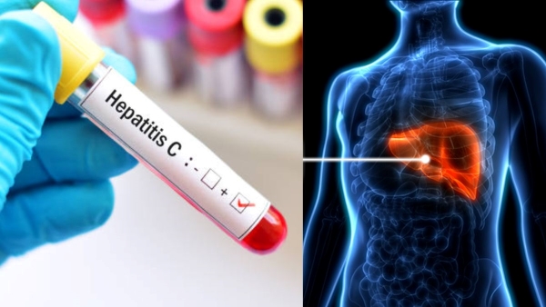 Hepatitis-C outbreak in Uttarakhand