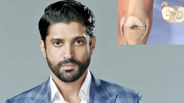 Meniscus Tear Surgery