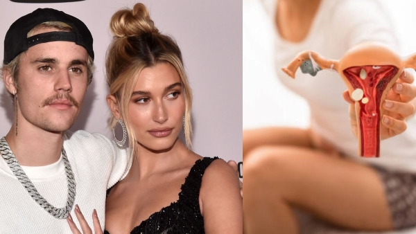 Hailey Bieber reveals she has ovarian cysts