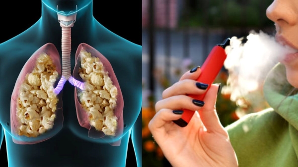 What Is Popcorn Lung