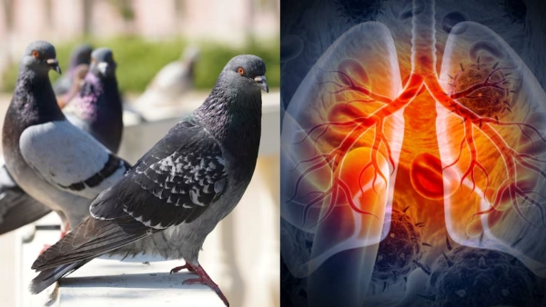 Karachi lung disease outbreak Karachi lung disease outbreak