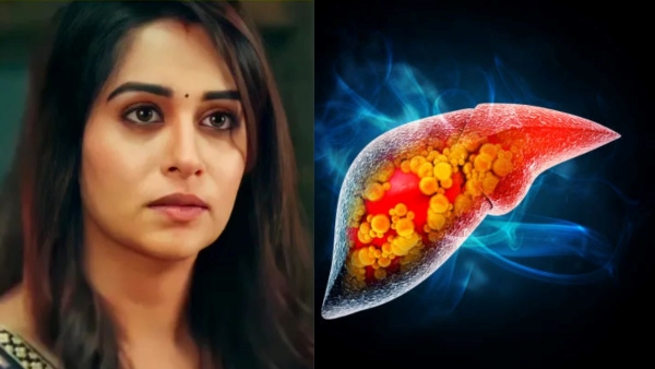 Dipika Kakar Diagnosed with Stage 2 Liver Cancer