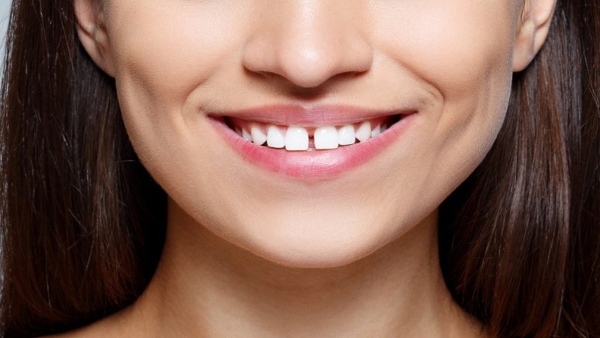 Lucky Signs In Teeth