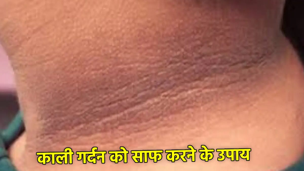 How To Remove Neck Darkness How To Remove Neck Darkness