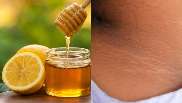 How To Remove Neck Darkness How To Remove Neck Darkness