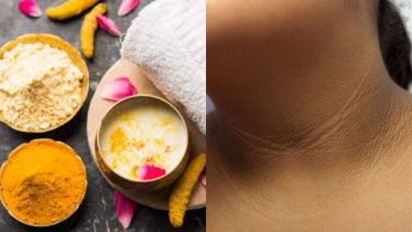 How To Remove Neck Darkness How To Remove Neck Darkness