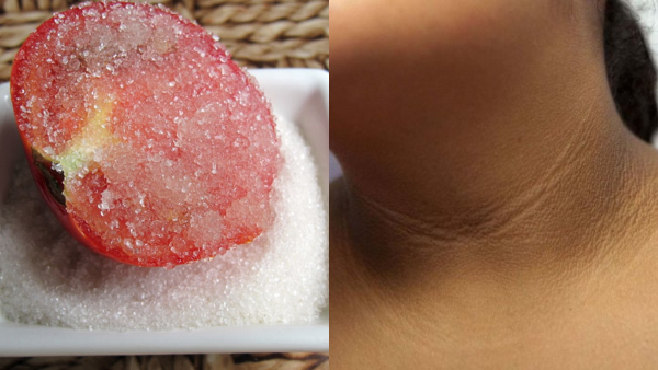 How To Remove Neck Darkness How To Remove Neck Darkness